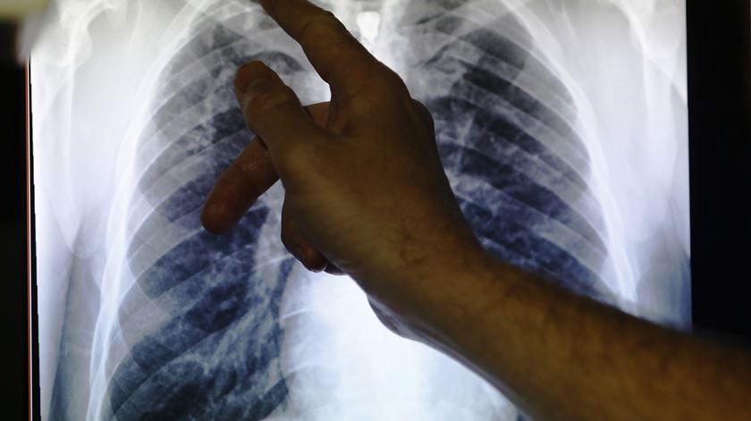 Gripenet volta permitir à população participar na vigilância das infeções respiratórias