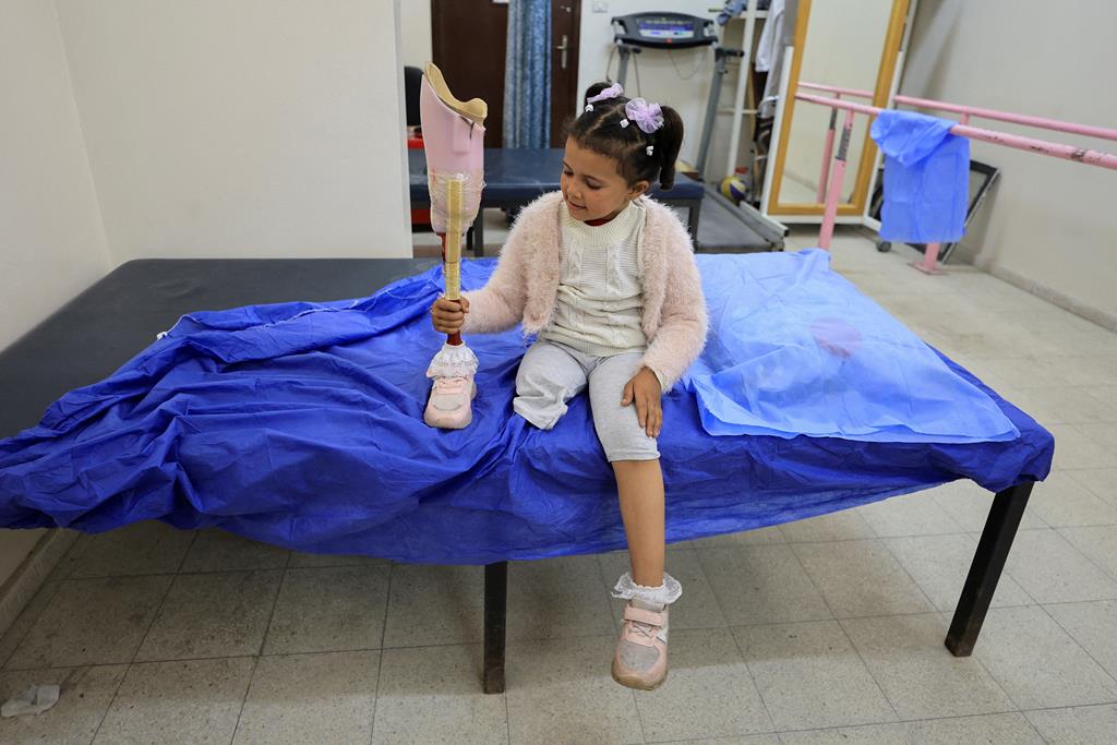 Em Gaza, o trauma da guerra está marcado no corpo