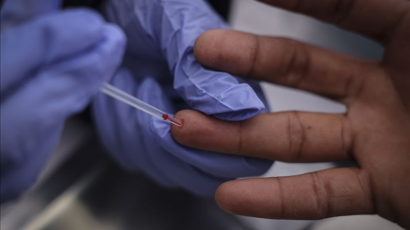 Centro Europeu alerta para aumento de infeções sexualmente transmissíveis entre jovens