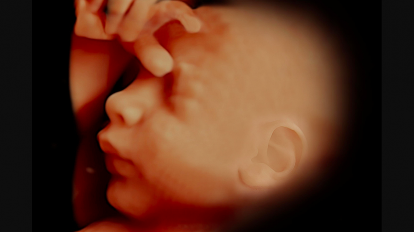 Há riscos para mães e fetos nas "ecografias emocionais", diz ERS