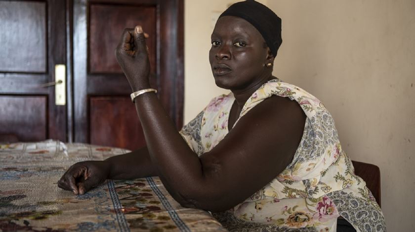 Oumie, baleada duas vezes no braço pelos soldados de Yahya Jemmeh enquanto tentava salvar uma menina. Foto: Jason Florio