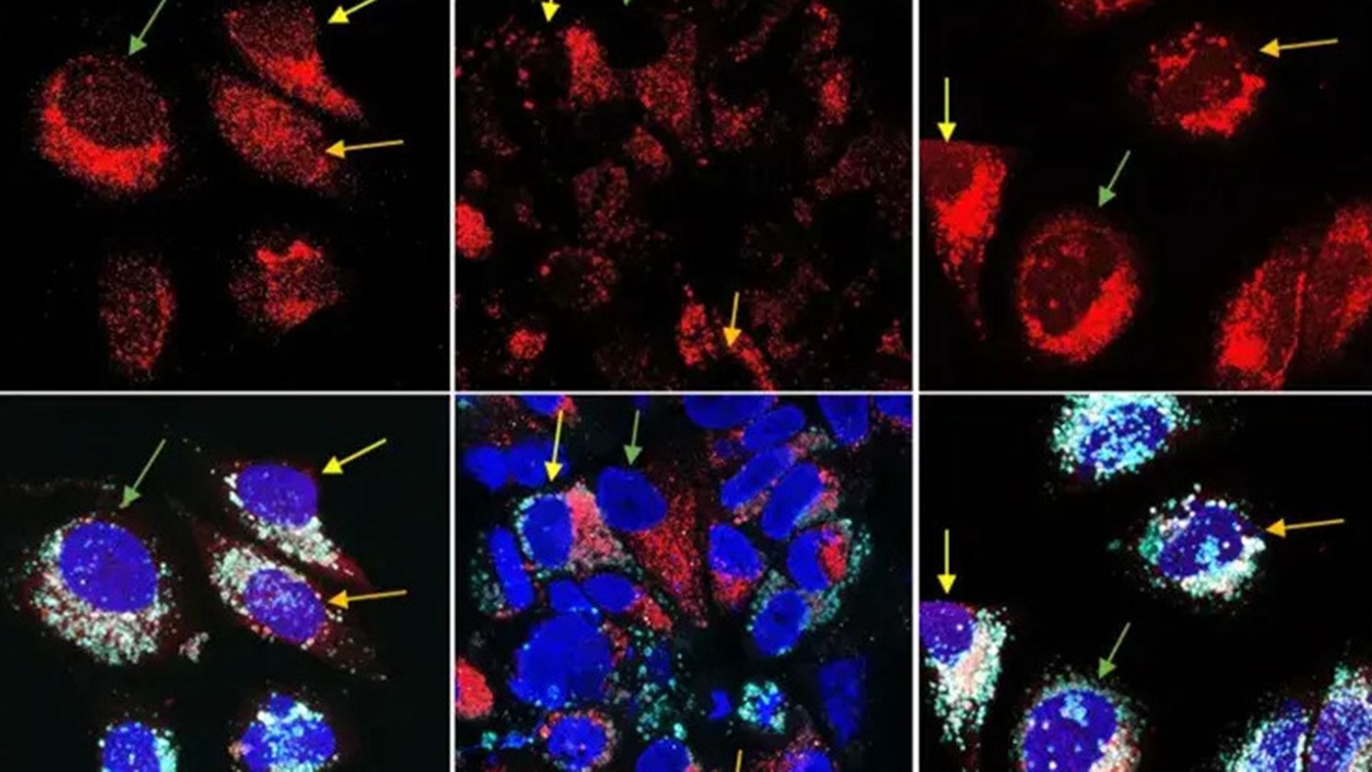 Cientistas testam tratamento mais eficaz contra cancro com menos doses de quimioterapia