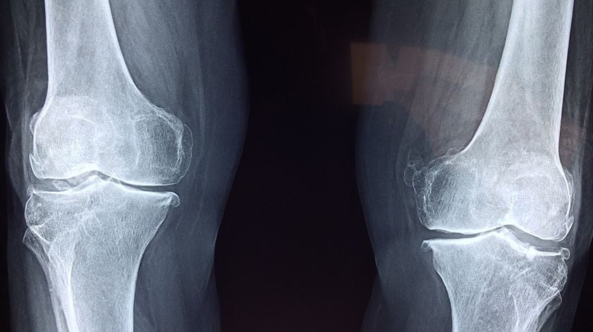 Exames de radiologia custaram 131 milhões em 2024